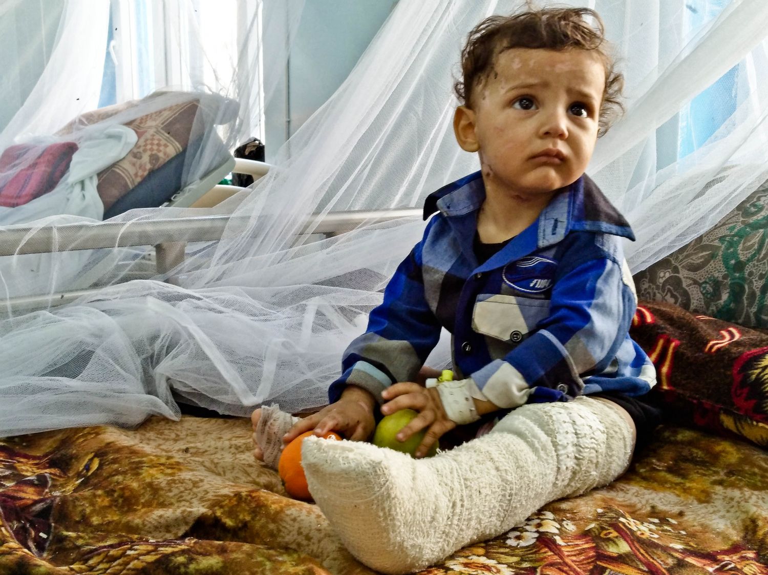 Bild von Ali, ein kleiner Junge, der schwer verletzt wurde und beide Beine in Gips hat.